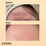 قیمت سرم پوست کوزارکس مدل حلزون